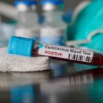 За еден ден над 18.000 заразени со коронавирус во Србија